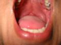 176-7696_IMG